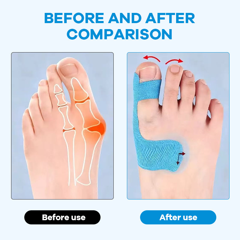 Vorgeschnittenes Kinesiologie-Tape für Hallux valgu